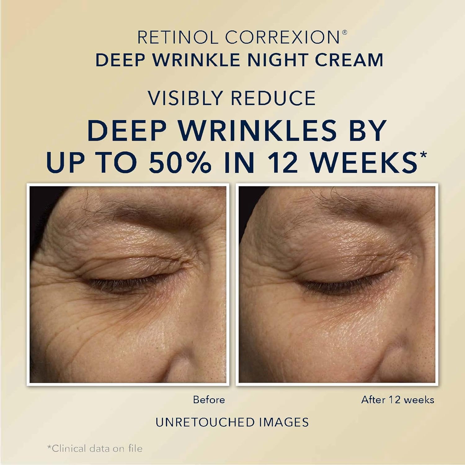 Retinol Anti-Aging Night Cream & Under Eye Care Set k7m
