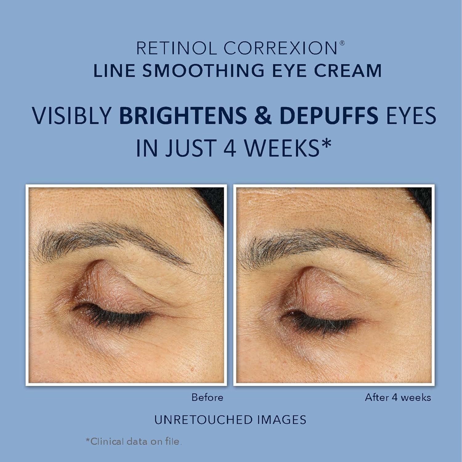 Retinol Anti-Aging Night Cream & Under Eye Care Set k7m